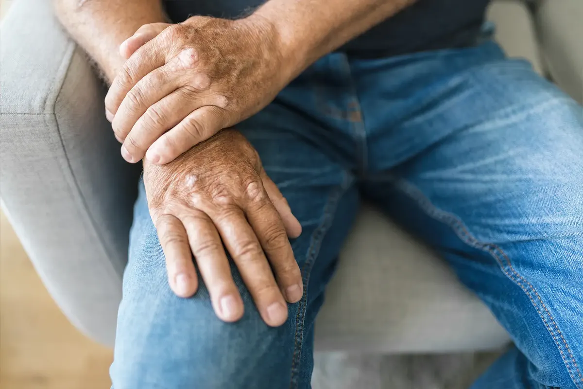 Older adult resting stiff, sore hands on his knee