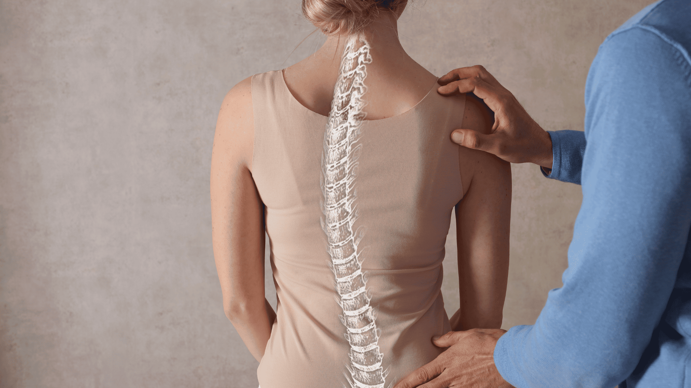 Can Scoliosis Come Back After Surgery?