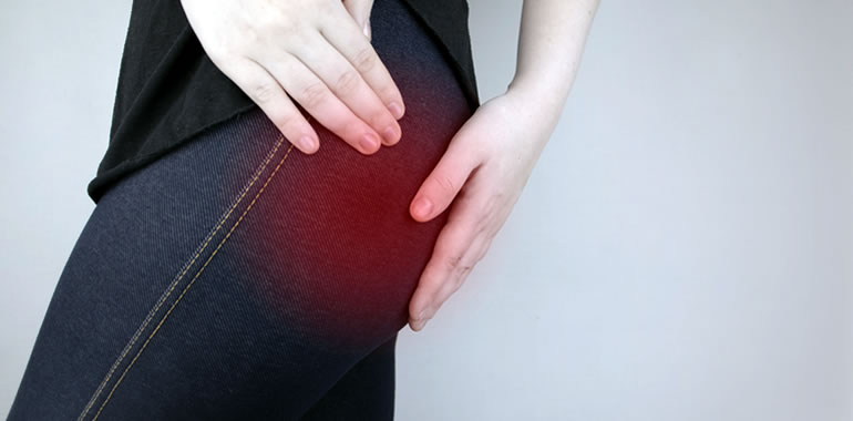 What is Piriformis Syndrome and What Can You Do About it?